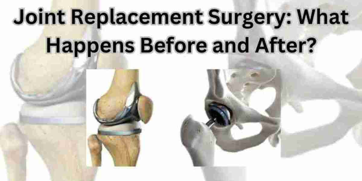 Joint Replacement Surgery: What Happens Before and After?