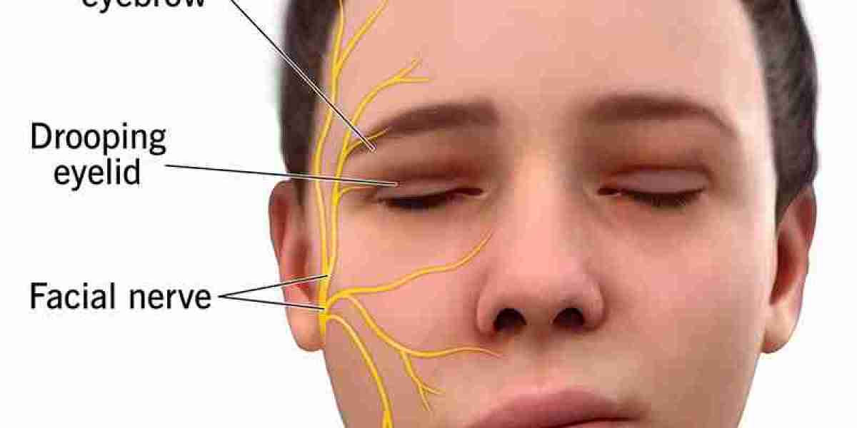 Bell’s Palsy Explained: What You Need to Know About Facial Paralysis