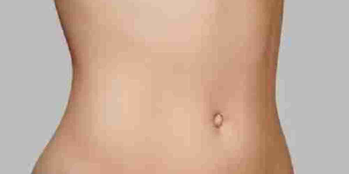Comparing Traditional vs. Advanced Liposuction in Islamabad